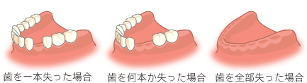 検査と治療計画